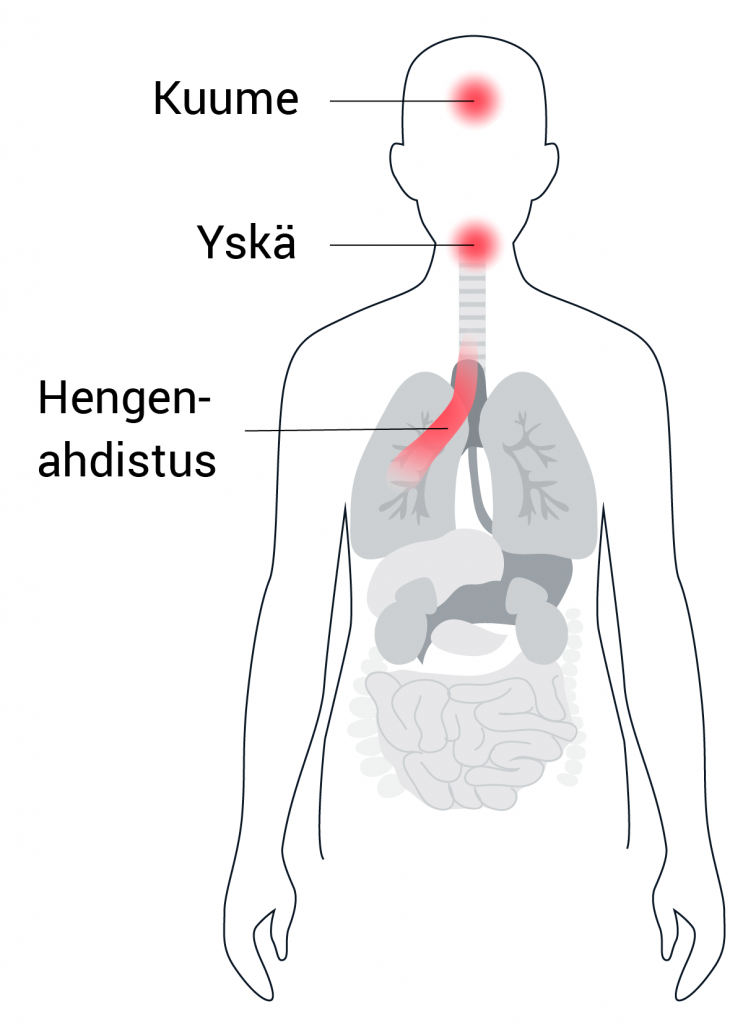 Miten Korona Alkaa