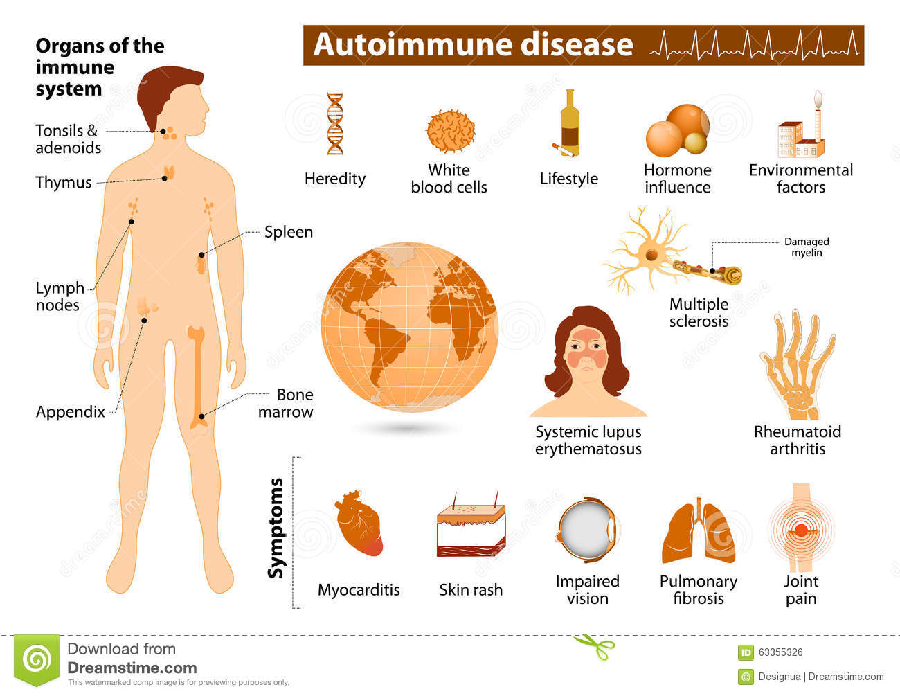 Malattia Autoimmune Ultima Italia