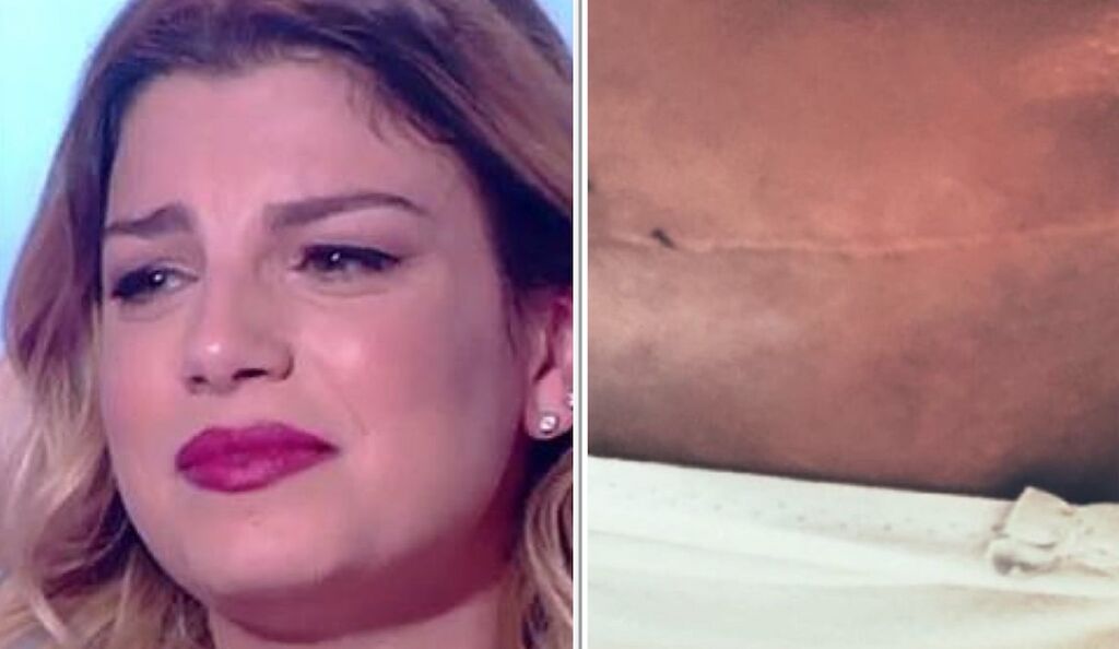 emma marrone malattia